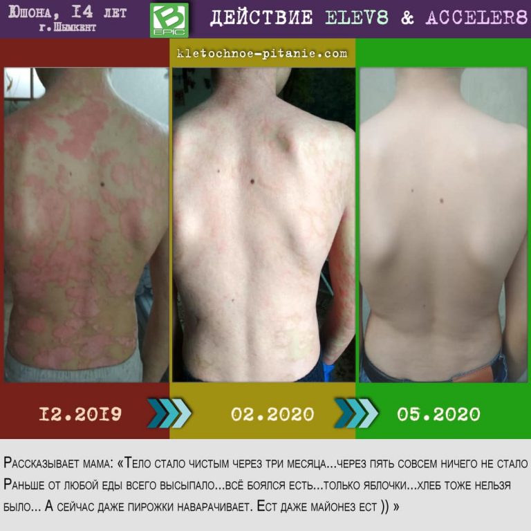 Elev8 от BEpic: что это, польза, состав, отзывы, купить